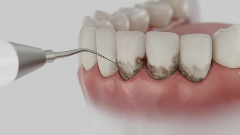 Reliable Dental contractor in Sarasota, FL by Smile Center Dentistry